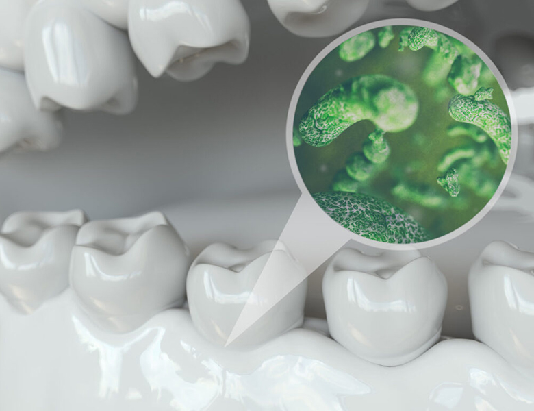 外苑前（東京）の歯医者、Angel矯正歯科・歯科口腔外科でブルーラジカル治療