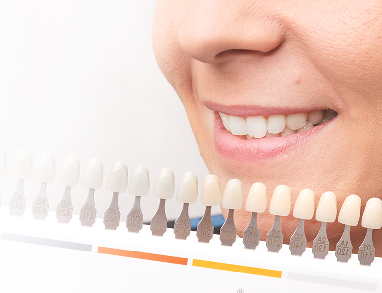 外苑前（東京）の歯医者、Angel矯正歯科・歯科口腔外科でホワイトニング