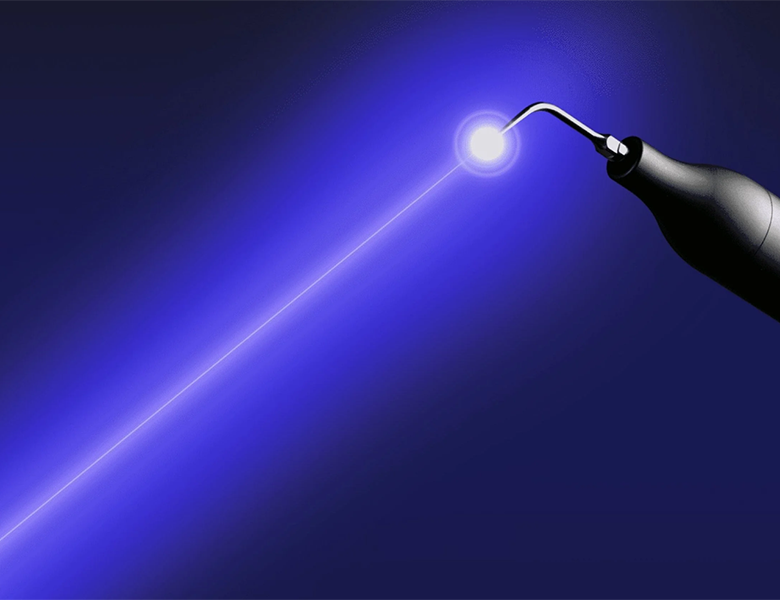 東京都港区外苑前の歯医者、Angel矯正歯科・歯科口腔外科のブルーラジカル