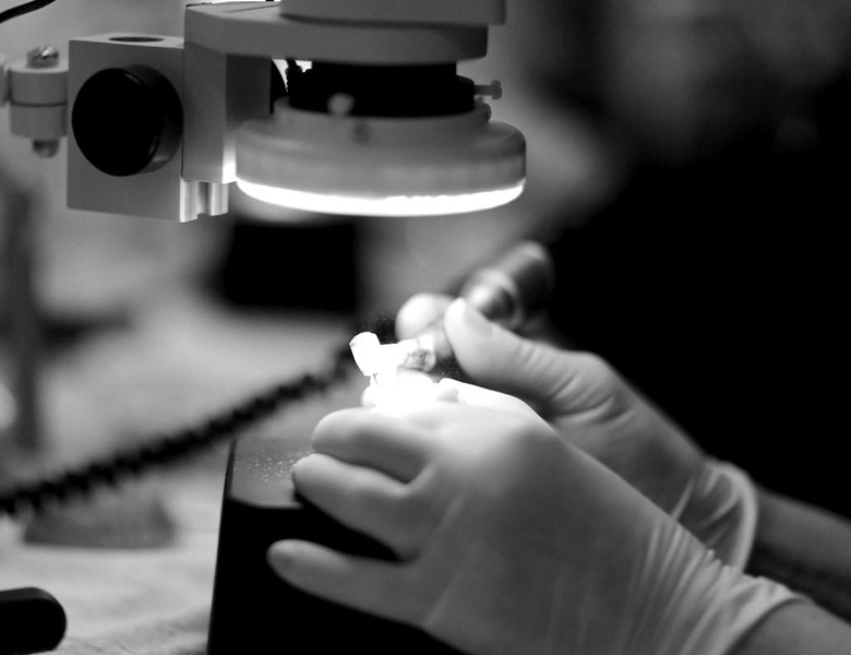 外苑前（東京）の歯医者、Angel矯正歯科・歯科口腔外科でマイクロスコープ精密治療