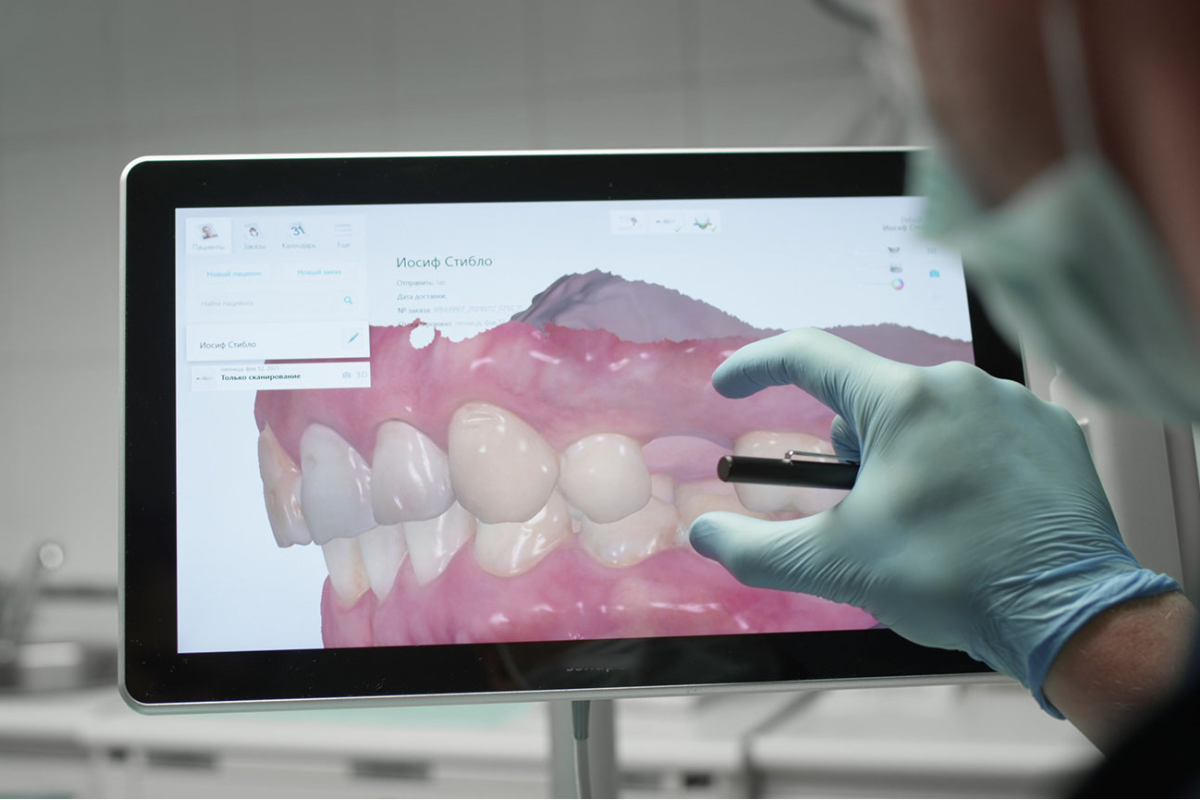 外苑前（東京）の歯医者、Angel矯正歯科・歯科口腔外科の口腔内スキャナーiTero(アイテロ)