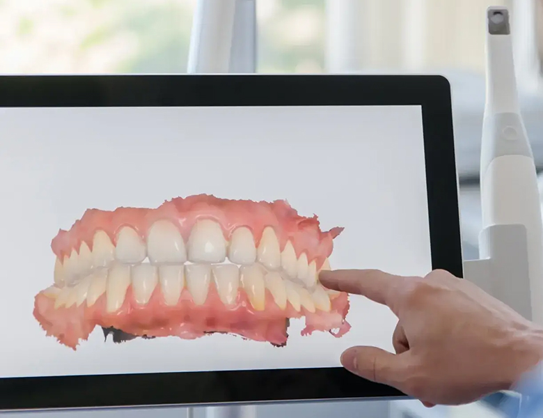 外苑前（東京）の歯医者、Angel矯正歯科・歯科口腔外科で予防歯科