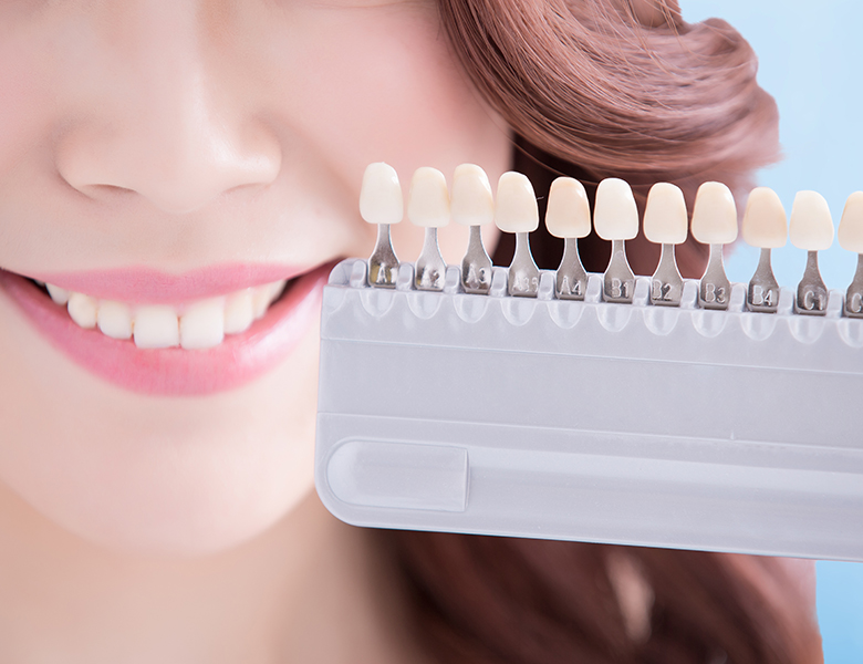 外苑前（東京）の歯医者、Angel矯正歯科・歯科口腔外科でホワイトニング