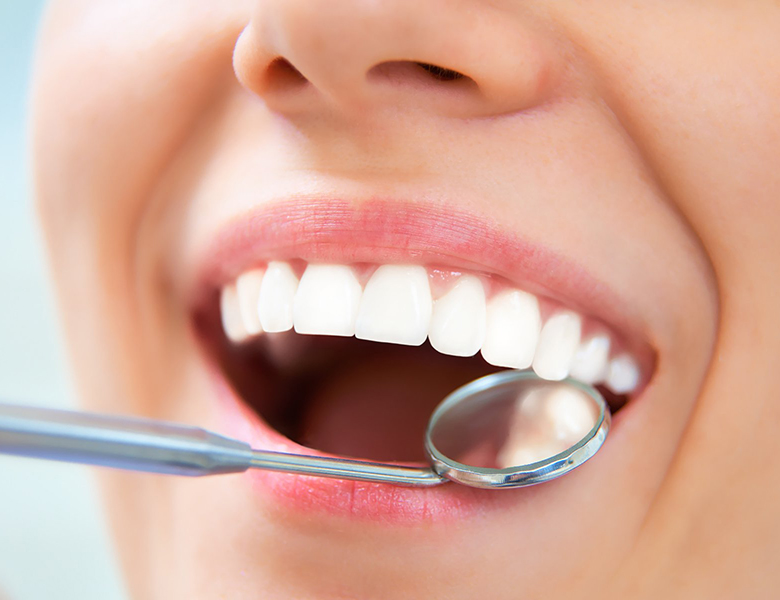 外苑前（東京）の歯医者、Angel矯正歯科・歯科口腔外科で予防歯科