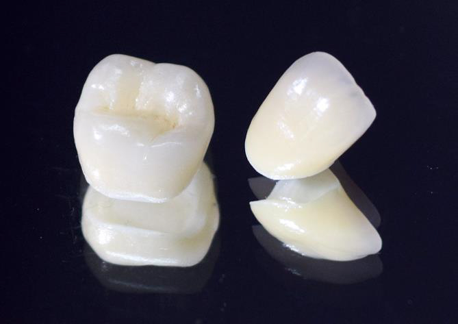 外苑前（東京）の歯医者、Angel矯正歯科・歯科口腔外科の審美歯科治療